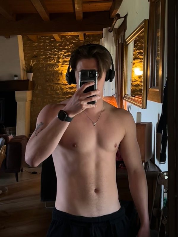 Client before ACL rehab